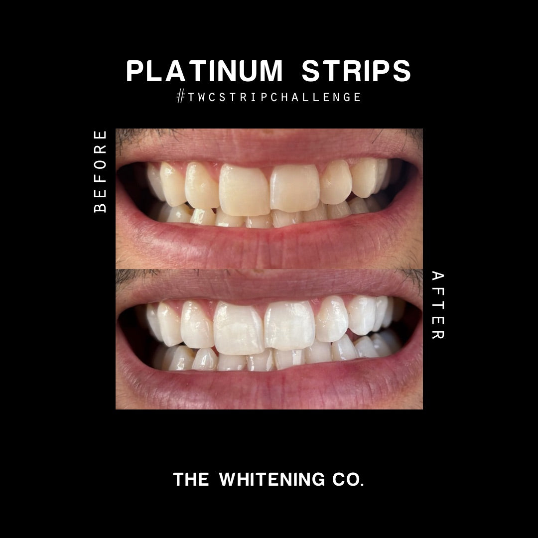 Platinum Arctic Spritz Strips x14 - Teeth Whitening Strips